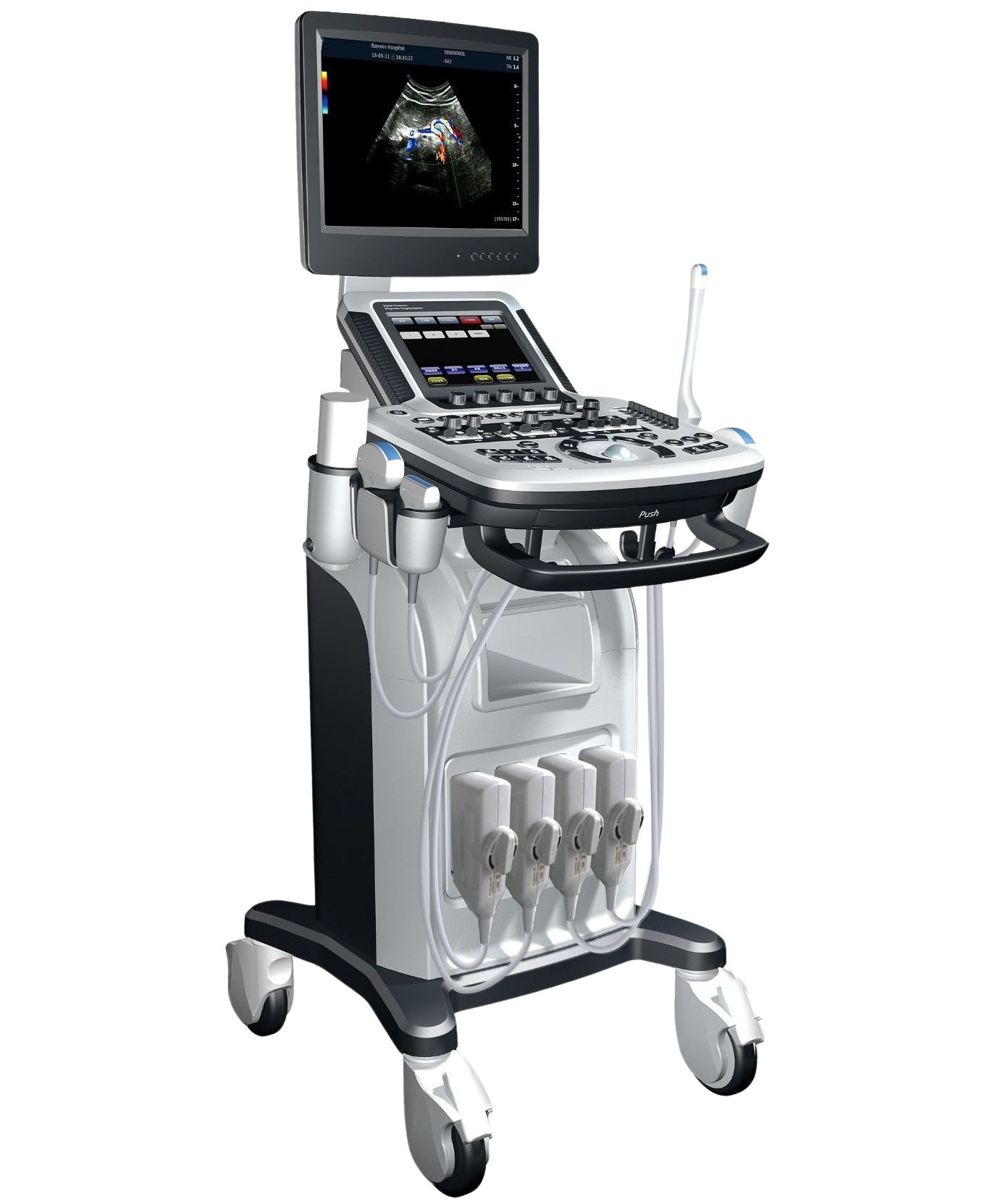 Refurbished ultrasound system