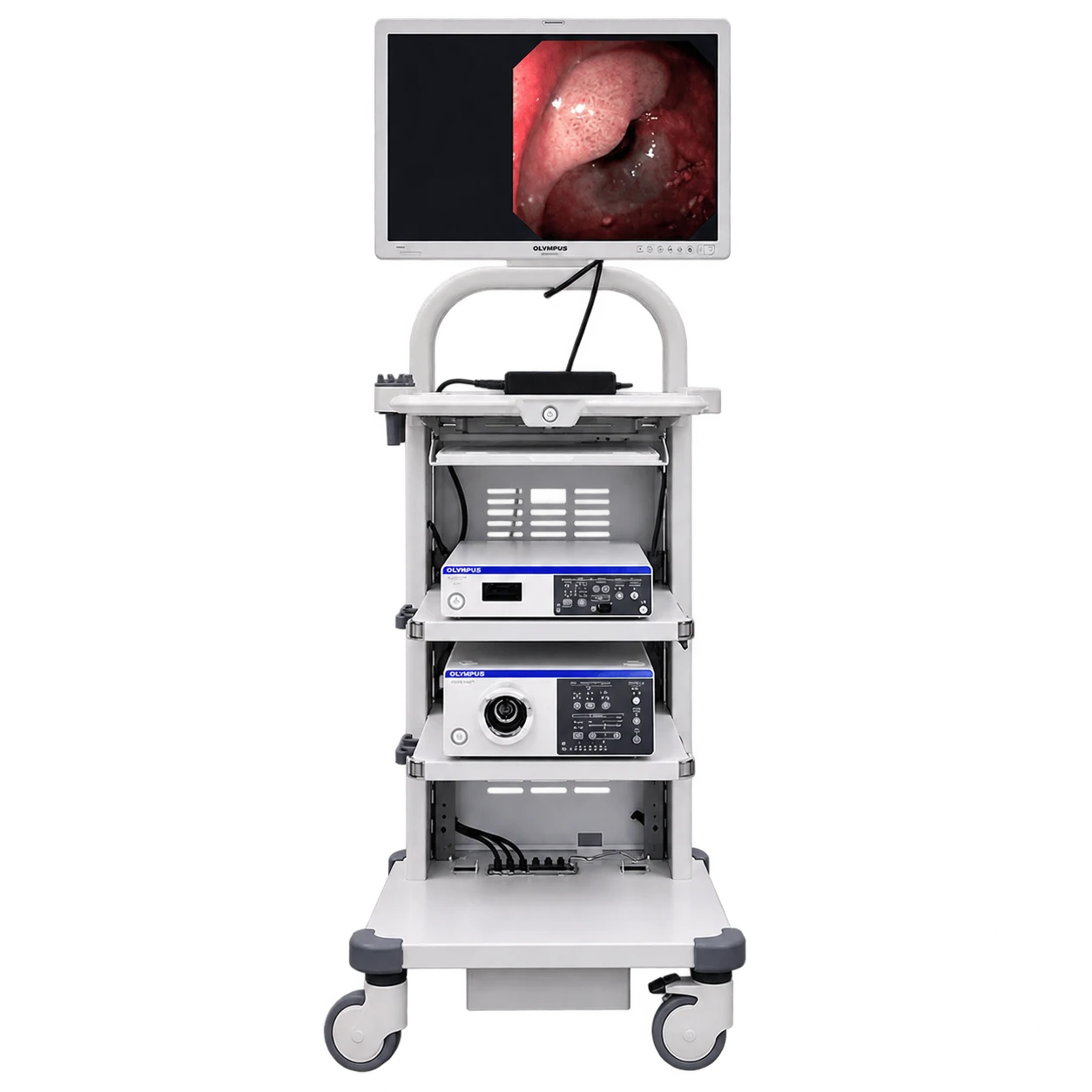 Used ultrasound system